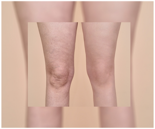 Tabletten gegen Cellulite und für Verbesserung der Kondition der Haut mit natürlichen Extrakten Cellinea 60 Kapseln