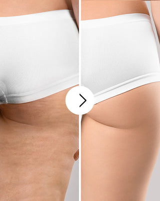 Tabletten gegen Cellulite und für Verbesserung der Kondition der Haut mit natürlichen Extrakten Cellinea 60 Kapseln_3 - 3