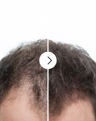 Kapseln gegen Haarausfall mit verdichtender und stärkender Wirkung Follixin 60 Kapseln_2 - 2