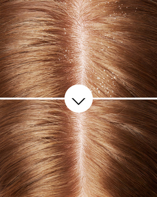 Anti-Schuppen-Shampoo von Nutridome mit Pirocton-Olamin und feuchtigkeitsspendender Wirkung