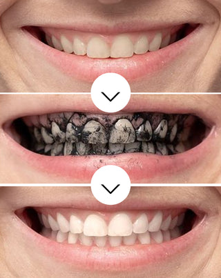 Smilebite Zahnaufhellungspulver mit Kokosnusskohle